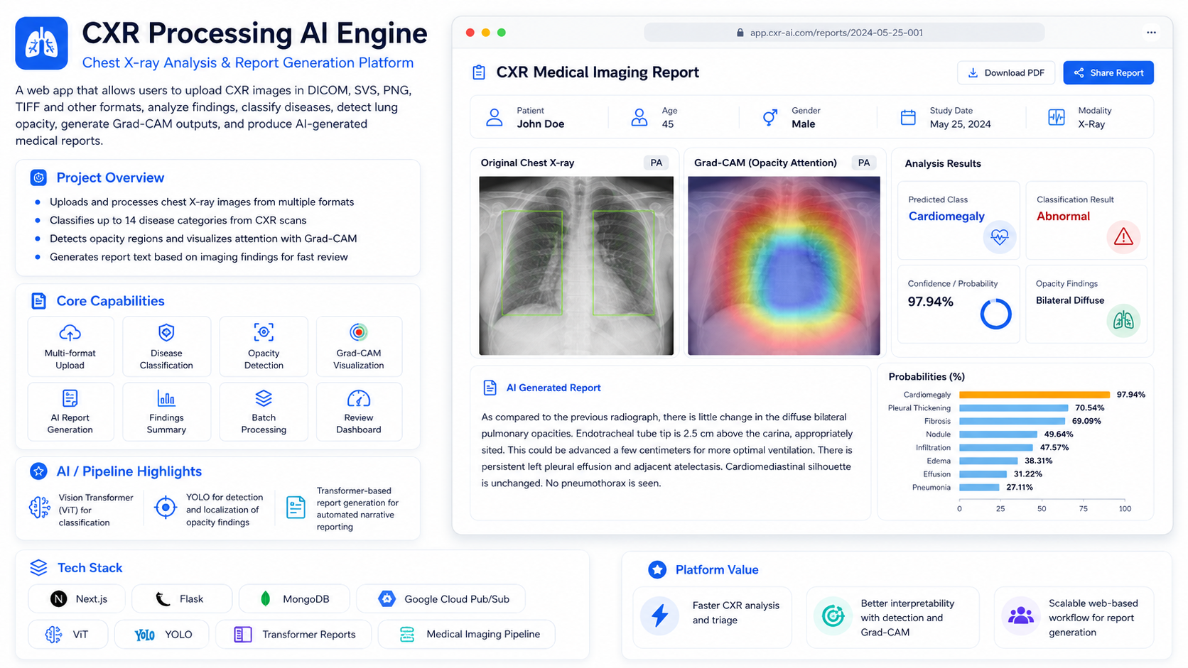 CXR Processing AI Engine